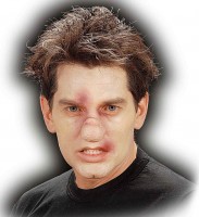 Kartoffelnasen Applikation